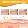 Ximonth Beesvenom Wart Care Spray, s Flesh Particle Mole Smooth Skin Wart Spray